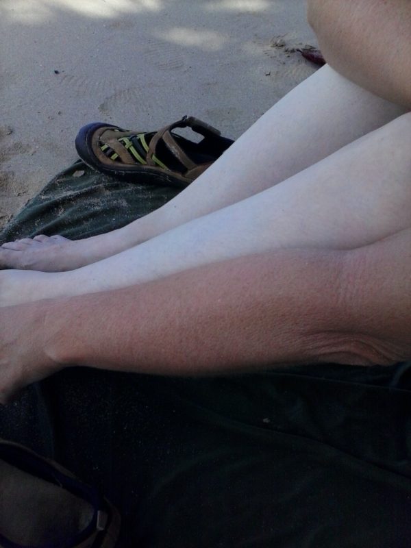 A woman with her tan arm being held in comparison to her pale legs on a beach.